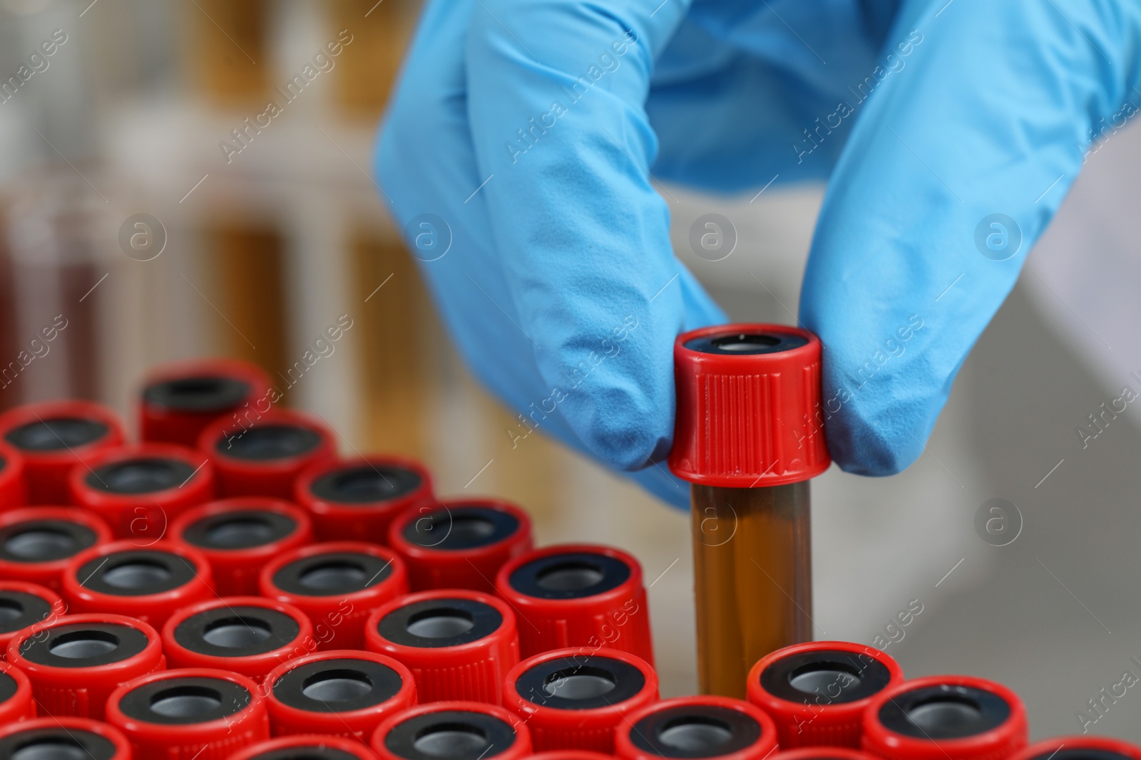 Photo of Scientist taking test tube with brown liquid from stand, closeup