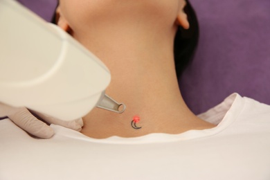 Young woman undergoing laser tattoo removal procedure in salon, above view