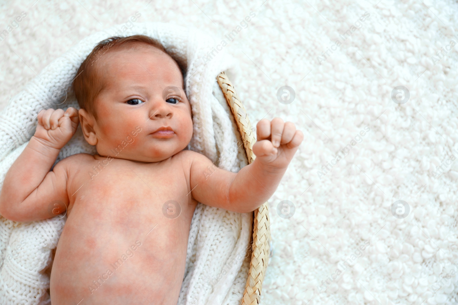 Image of Little child with red rash lying in cradle, top view. Baby allergies