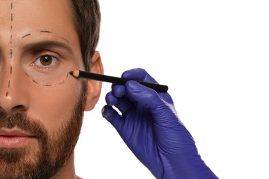 Doctor with pencil preparing patient for cosmetic surgery operation on white background, closeup