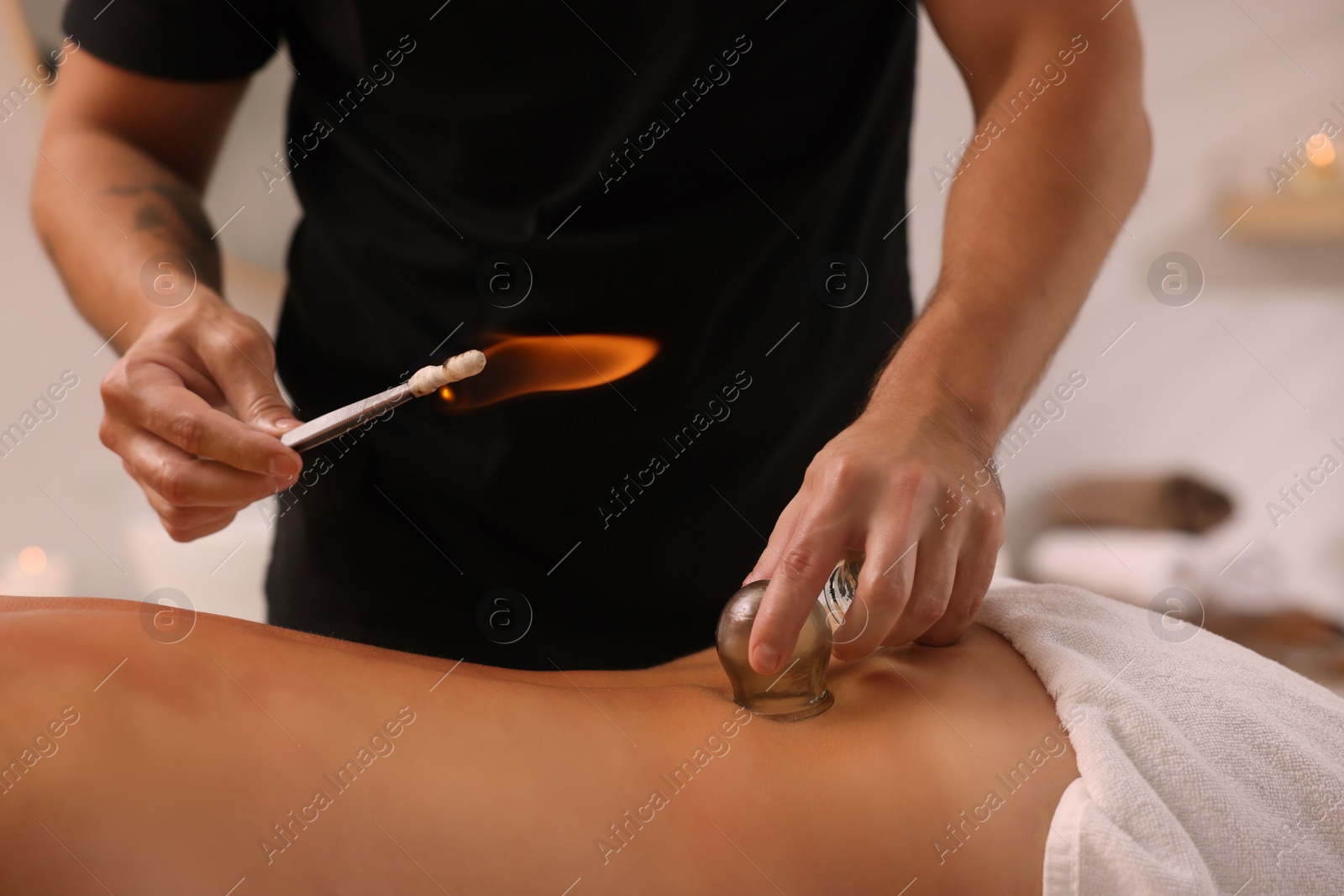 Photo of Therapist giving fire cupping treatment to patient indoors, closeup