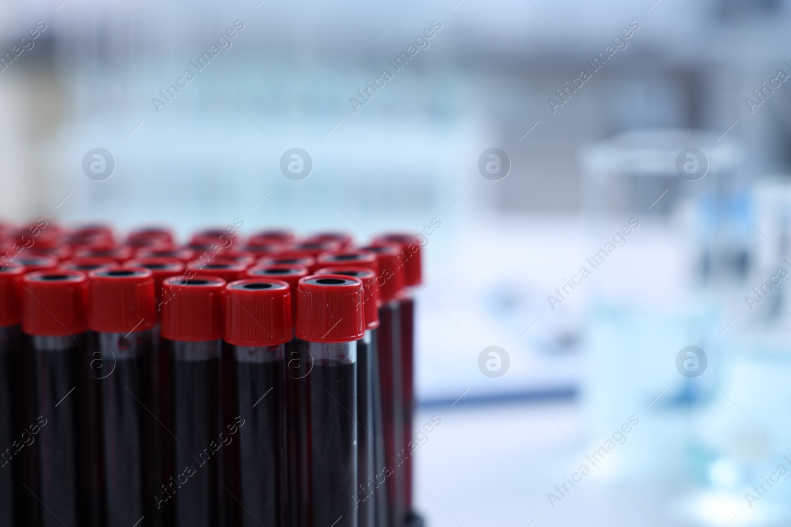 Photo of Test tubes with samples in laboratory, closeup. Space for text