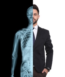 Man in suit, half x-ray photograph. Medical check
