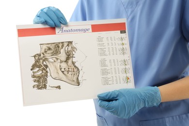 Photo of Doctor with visualization of human maxillofacial section for dental analysis printed on paper isolated on white, closeup. Cast of teeth