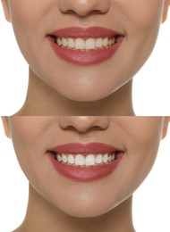 Collage with photos of woman before and after tooth whitening on white background, closeup