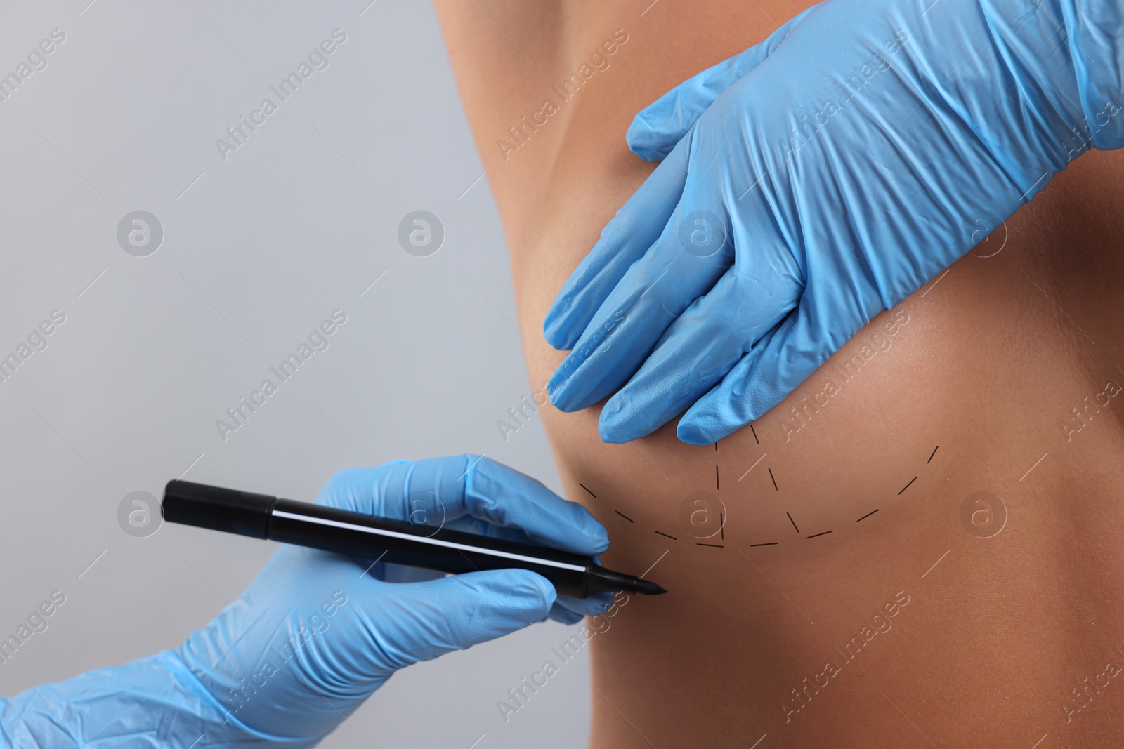 Image of Breast augmentation. Doctor with marker preparing woman for plastic surgery operation against light grey background, closeup. Space for text.