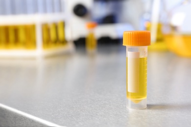 Photo of Container with urine sample on table in laboratory, space for text. Medical analysis