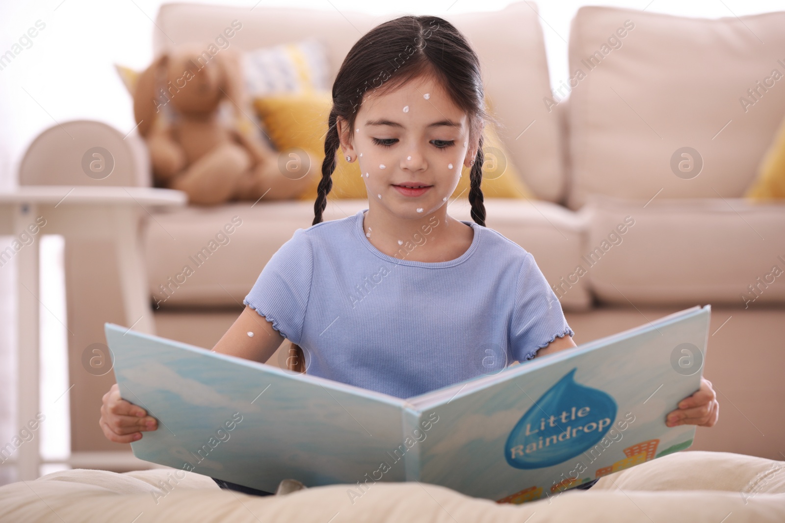 Photo of Little girl with chickenpox reading book at home