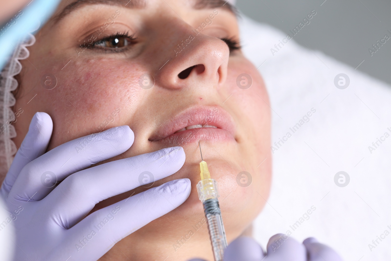 Photo of Woman undergoing face biorevitalization procedure in salon, closeup. Cosmetic treatment