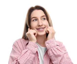 Portrait of smiling woman with dental braces on white background