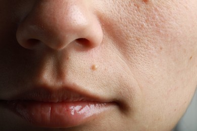 Closeup view of woman with healthy skin on light grey background