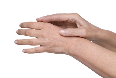 Photo of Closeup of woman's hands with aging skin on white background. Rejuvenation treatment
