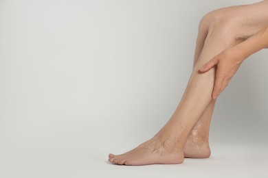 Photo of Closeup view of woman suffering from varicose veins on light background. Space for text