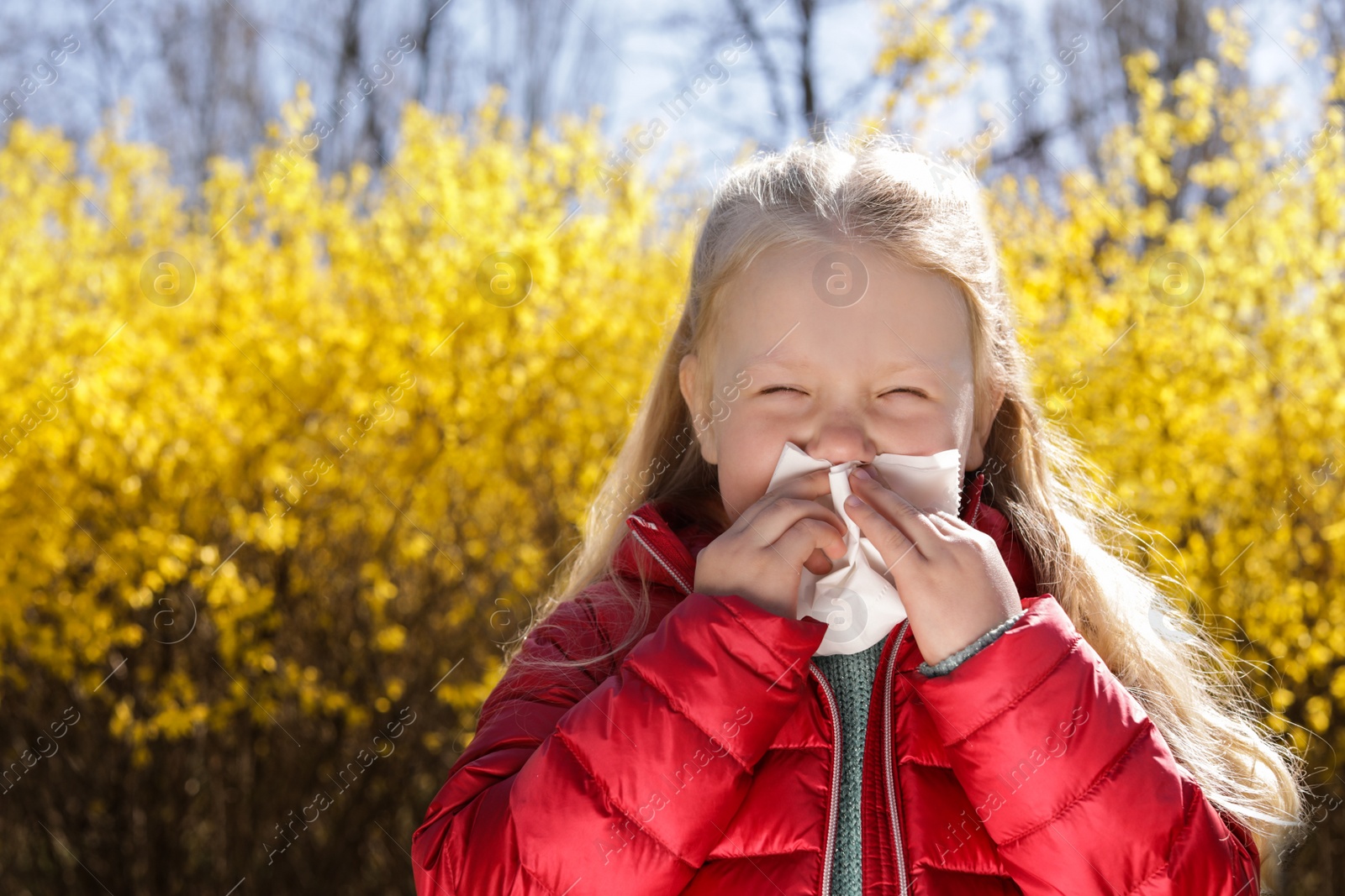 Photo of Little girl suffering from seasonal allergy outdoors, space for text