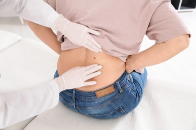 Dermatologist examining mature patient's birthmark in clinic, closeup