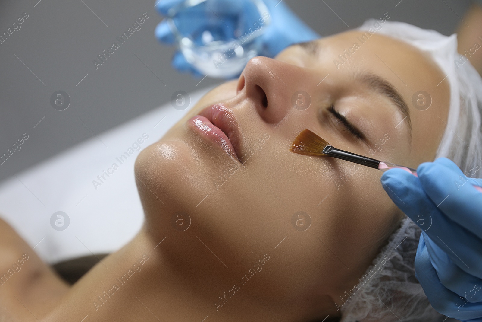 Photo of Young woman during face peeling procedure in salon, closeup