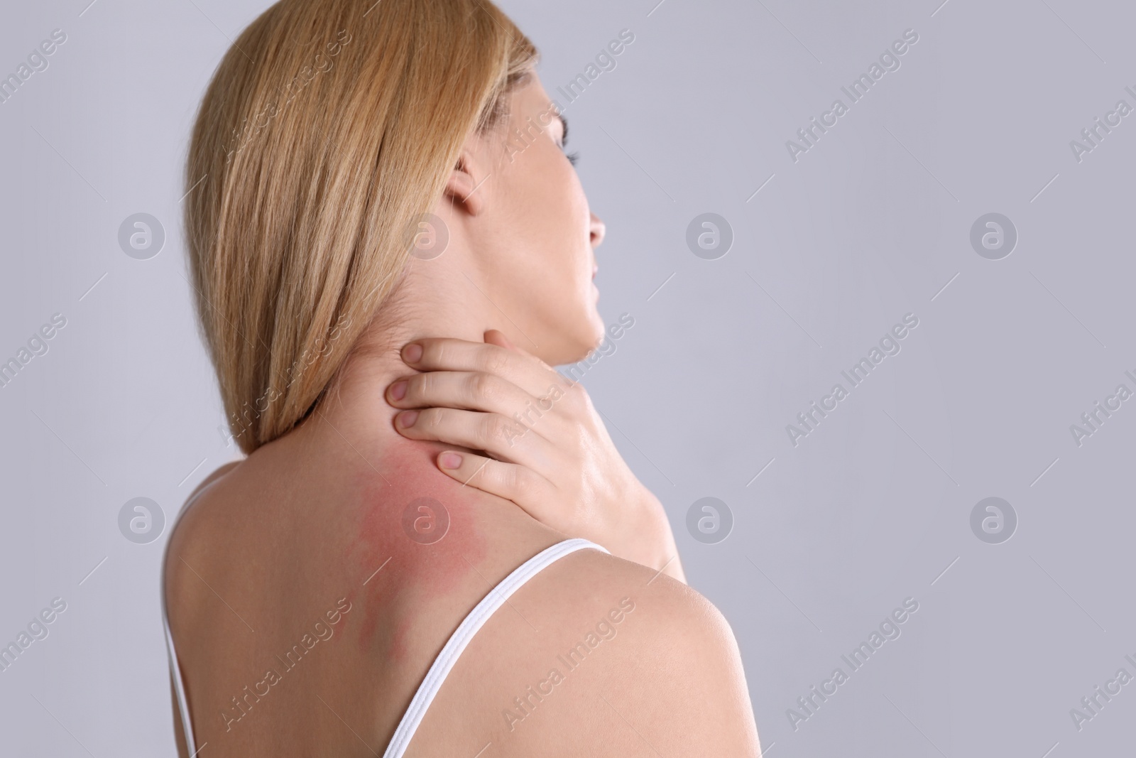 Photo of Woman with allergy symptoms scratching neck on grey background. Space for text