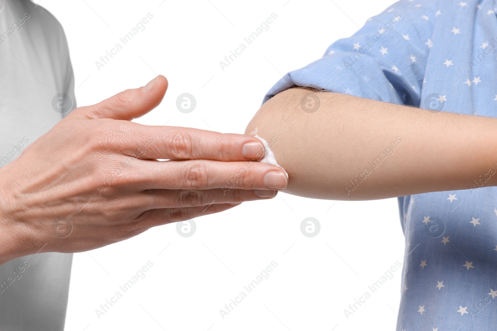 Photo of Mother applying ointment on her daughter's elbow against white background, closeup