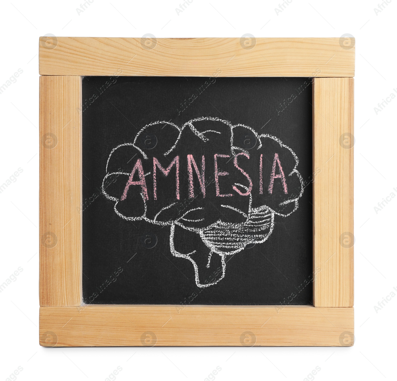 Photo of Blackboard with drawn brain and word Amnesia on white background