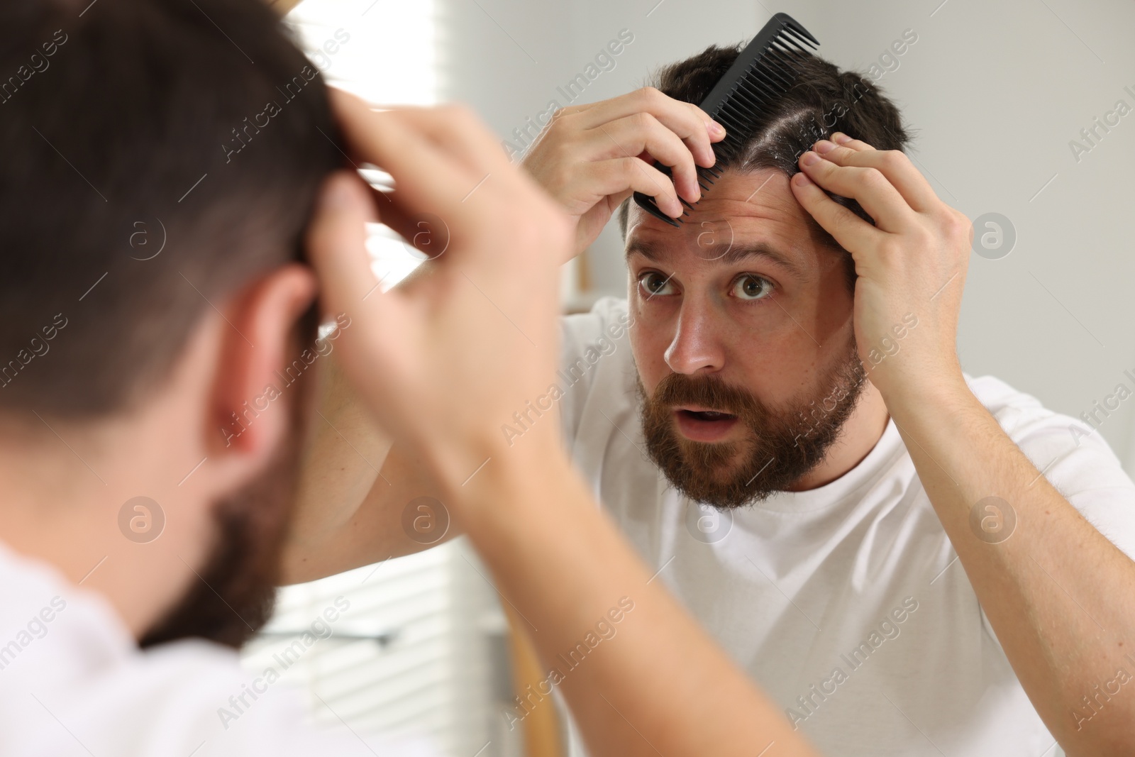Photo of Dandruff problem. Man with comb examining his hair and scalp near mirror indoors
