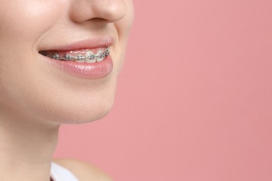 Smiling woman with dental braces on pink background, closeup. Space for text