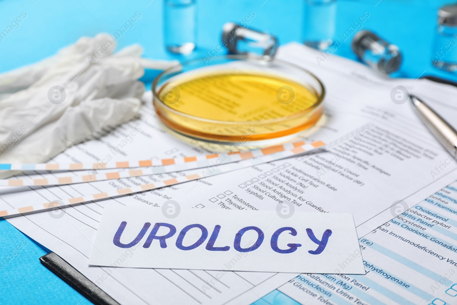 Photo of Composition with word "Urology" and test forms on color background