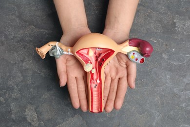 Photo of Woman with anatomical model of uterus at grey table, top view. Gynecology concept