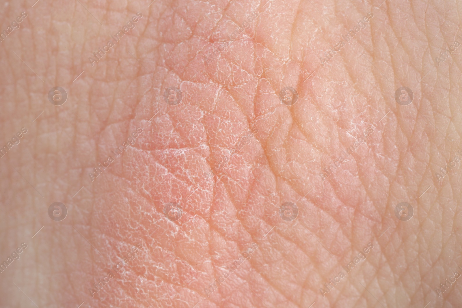 Photo of Texture of healthy skin as background, macro view