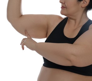 Photo of Obese woman with flabby arm on white background, closeup. Weight loss surgery