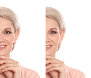 Mature woman before and after cosmetic procedure on white background 