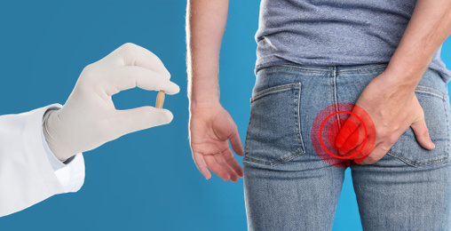 Image of Doctor holding suppository for hemorrhoid treatment and man suffering from pain on blue background, closeup
