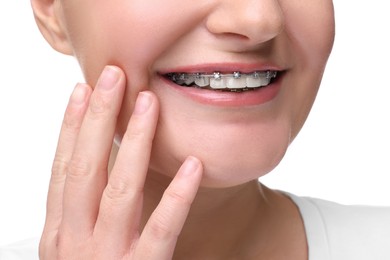 Photo of Smiling woman with dental braces on white background, closeup