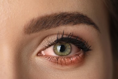 Image of Woman suffering from conjunctivitis, closeup of inflamed eye