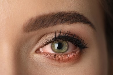 Woman suffering from conjunctivitis, closeup of inflamed eye