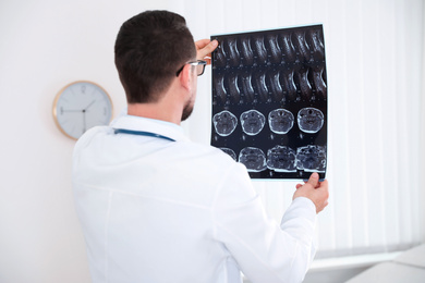 Professional orthopedist examining X-ray picture in clinic