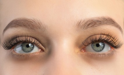 Image of Tired young woman with dark circles under eyes, closeup