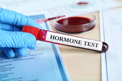 Photo of Hormones test. Scientist holding sample tube with blood at table, closeup