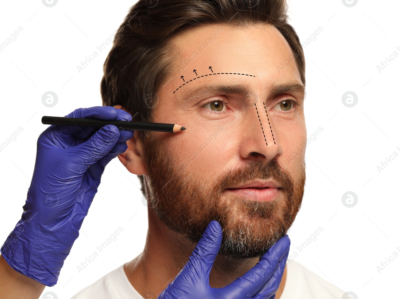 Image of Man preparing for cosmetic surgery, white background. Doctor drawing markings on his face, closeup