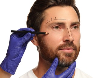 Man preparing for cosmetic surgery, white background. Doctor drawing markings on his face, closeup