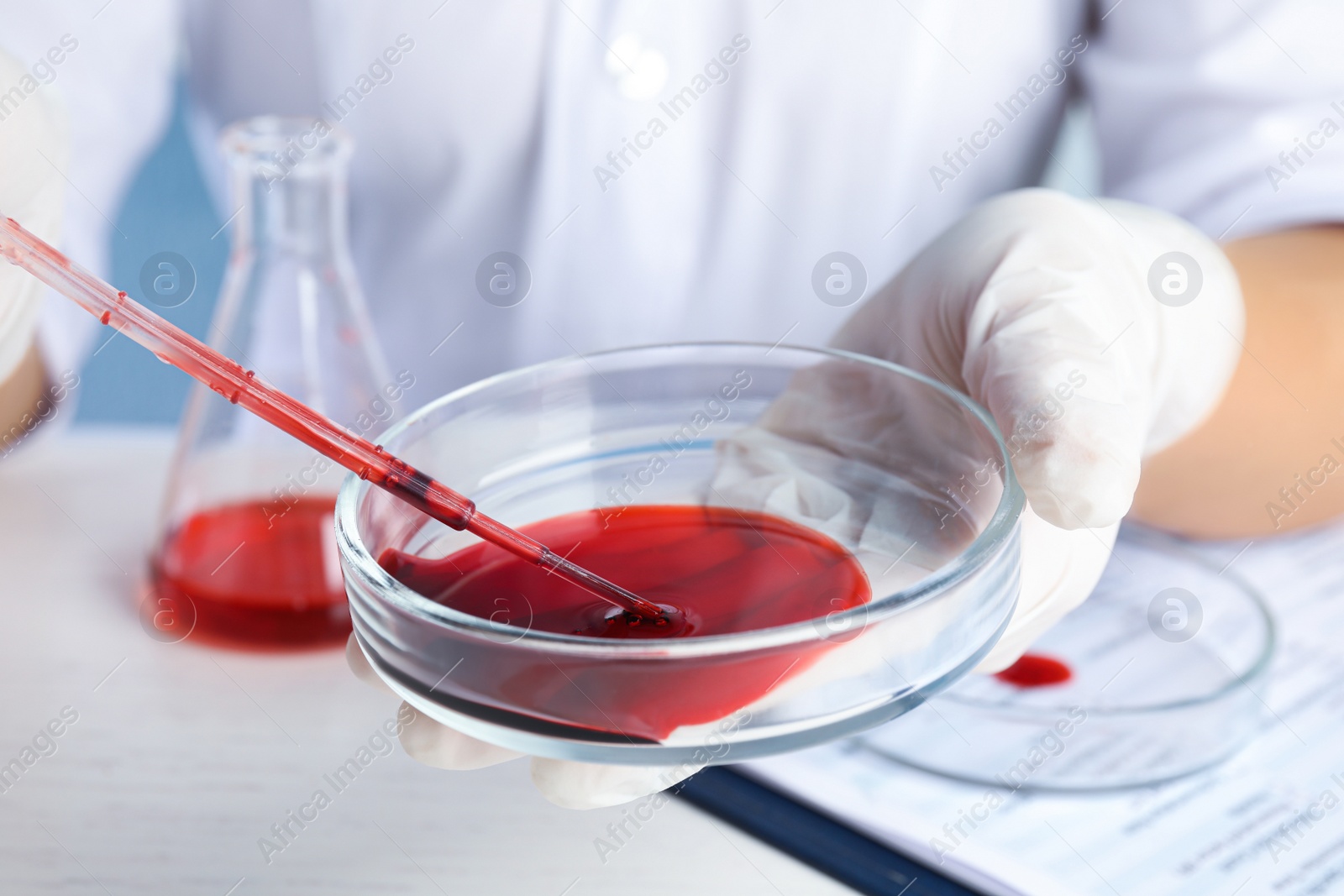 Photo of Scientist taking blood sample from Petri dish with pipette in laboratory, closeup. Virus research