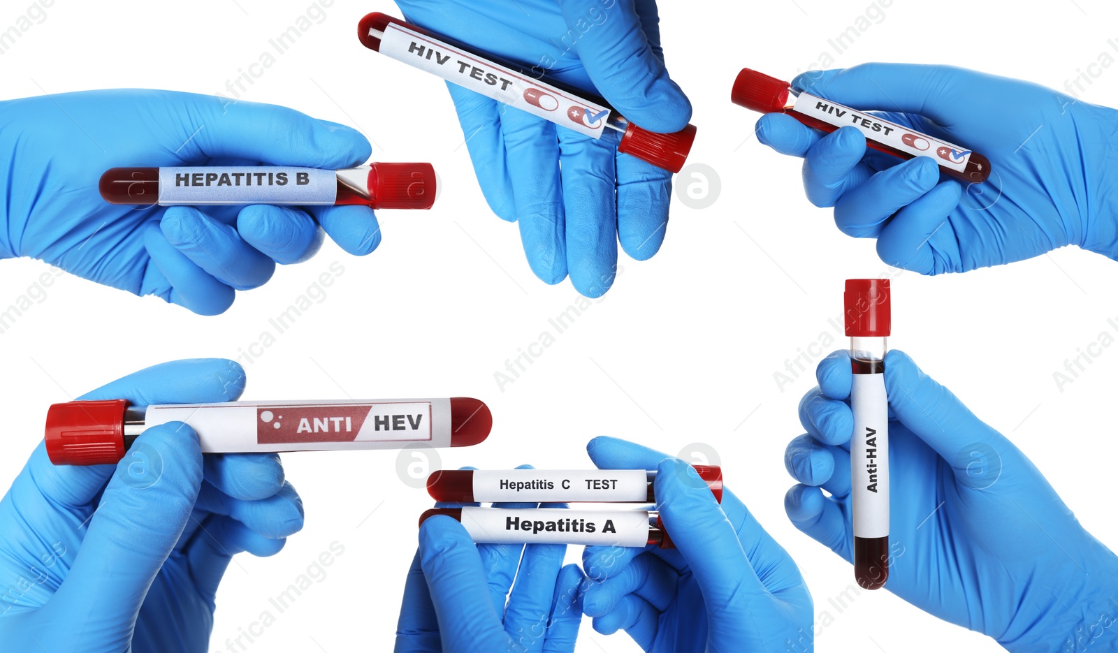 Image of Collage with photos of scientists holding test tubes with blood samples on white background, closeup