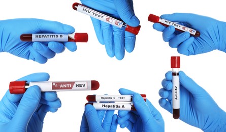Image of Collage with photos of scientists holding test tubes with blood samples on white background, closeup