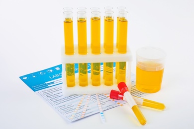 Photo of Laboratory ware with urine sample for analysis on white background