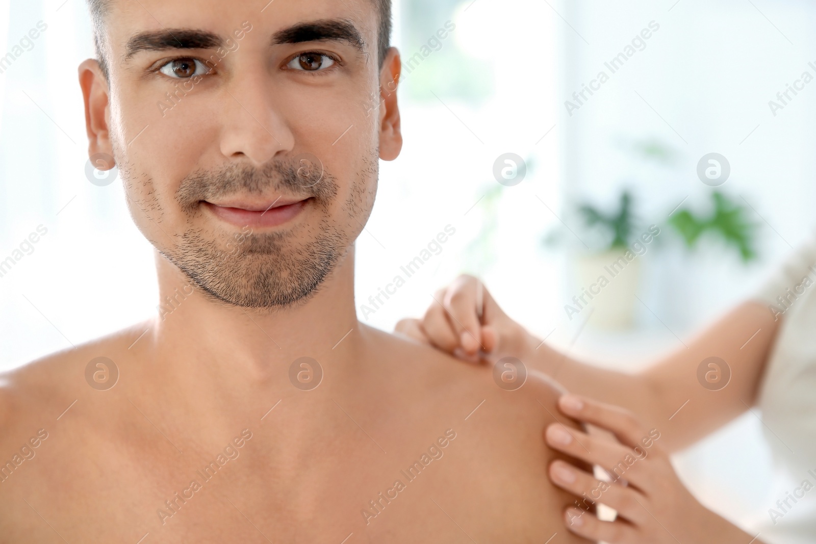 Photo of Young man undergoing acupuncture treatment in salon