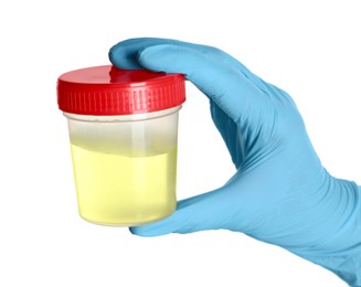 Photo of Doctor in gloves holding container with urine sample for analysis on white background, closeup