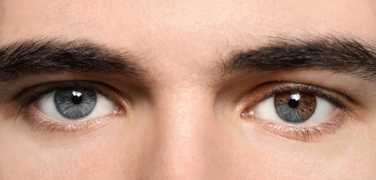 Image of Man with beautiful eyes of different colors, closeup. Heterochromia iridis