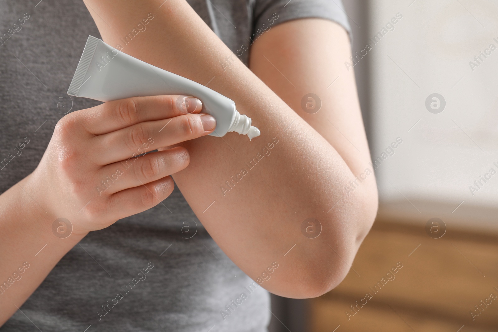 Photo of Woman applying ointment from tube onto her arm indoors, closeup