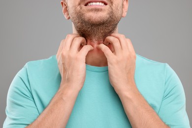 Photo of Allergy symptom. Man scratching his neck on light grey background, closeup