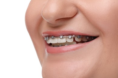 Smiling woman with dental braces on white background, closeup