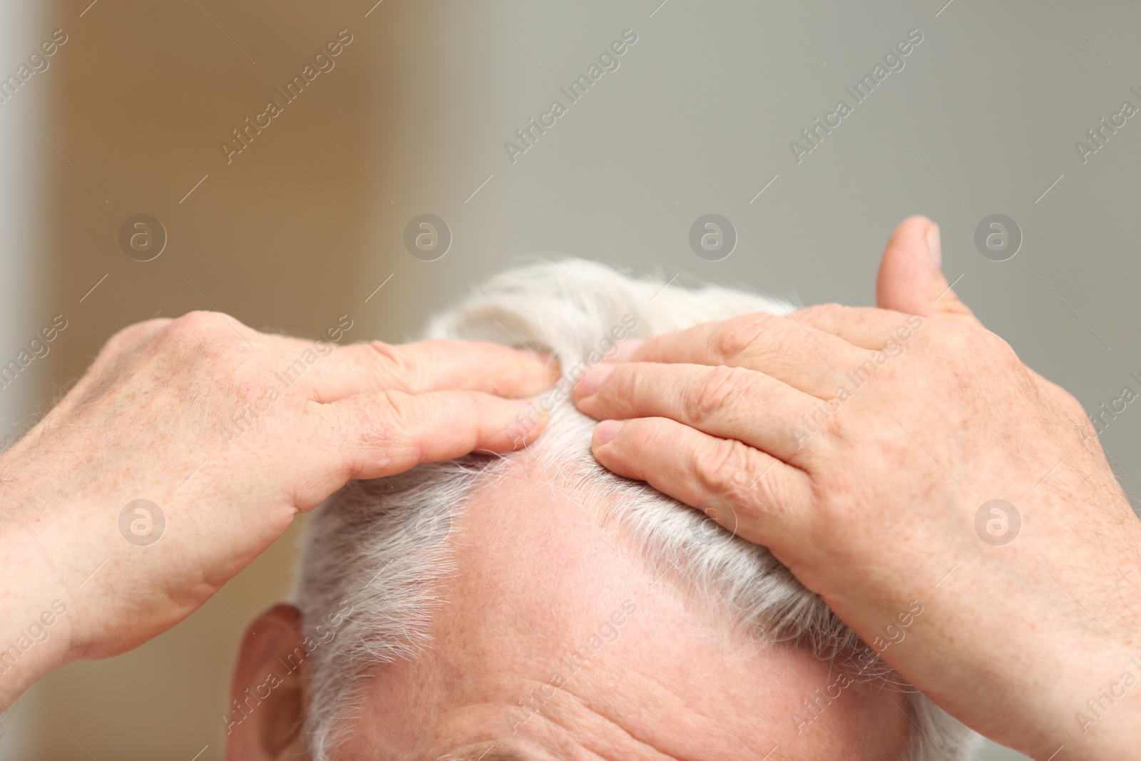 Photo of Senior man with hair loss problem indoors, closeup